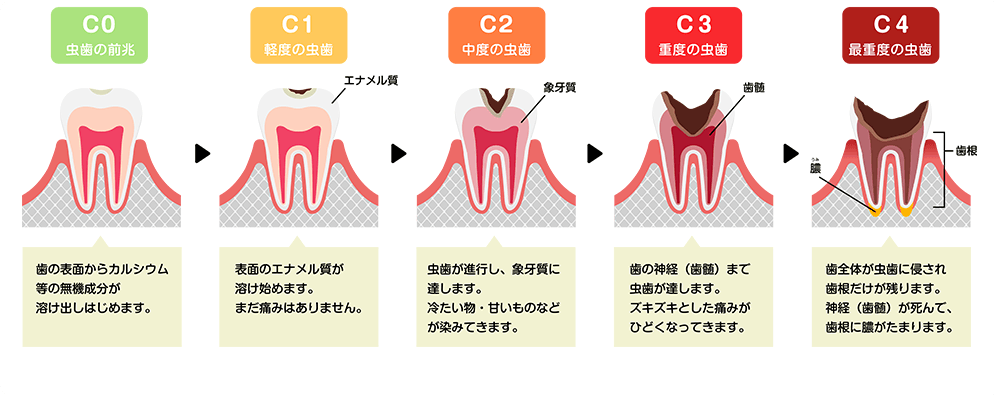 5つの症状