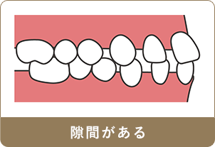 隙間がある