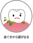 歯茎から膿が出る